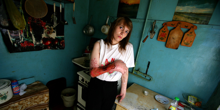 Фотопроект «СПИД. Открытые лица»: 6 лет, 11 городов, 800 историй / Фонд Олени Пінчук