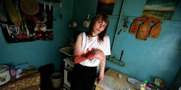 У Кіровограді презентували соціальний фотопроект «Життя без маски, біль без гриму» / Фонд Олени Пінчук