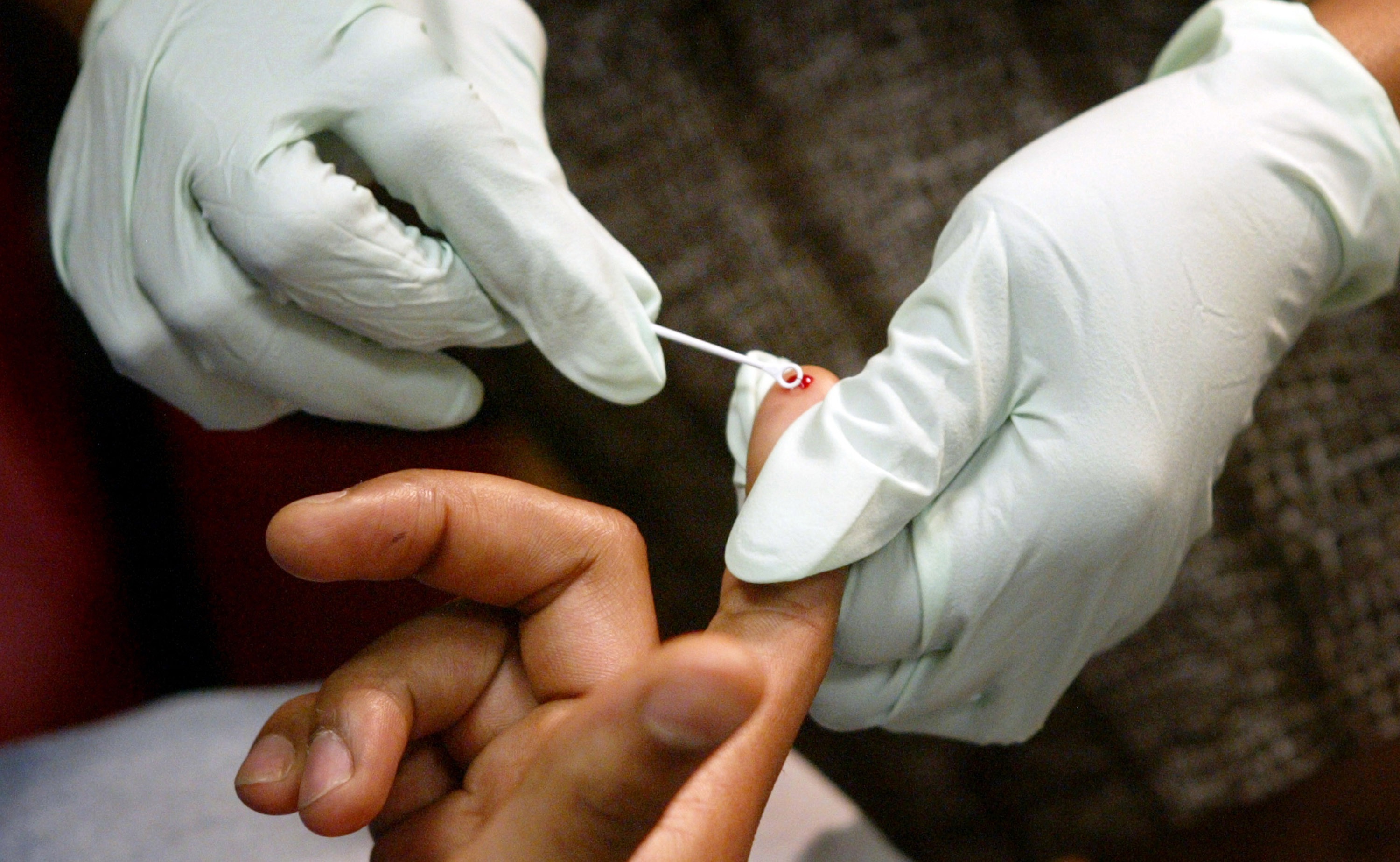 hiv-testing