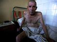 Херсон, 18 августа 2005 г.
Заключенный с тяжелыми последствиями ВИЧ-инфекции в палате интенсивной терапии в больнице для заключенных с ВИЧ/СПИДом херсонской тюрьмы.